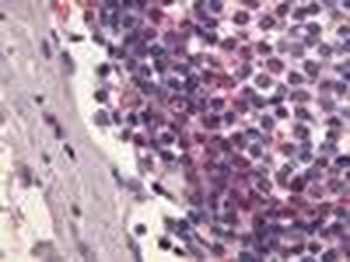 S1PR4/SIP4/EDG6 Antibody