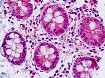 SGK3 Antibody