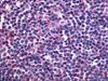 S1PR4/SIP4/EDG6 Antibody