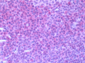 CCR7 Antibody