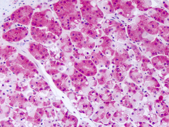 PRKD2/PKD2 Antibody