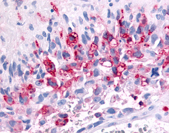 PRKD2/PKD2 Antibody