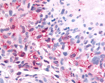 PAK6 Antibody