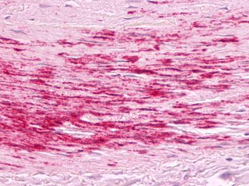 B1R/BDKRB1 Antibody