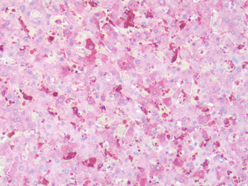 CXCR1 Antibody