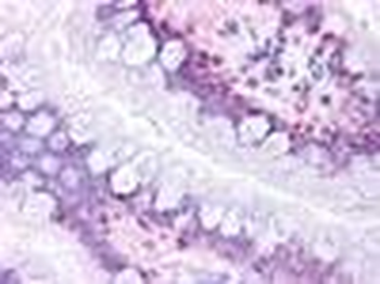 Prostaglandin D2 Receptor Antibody