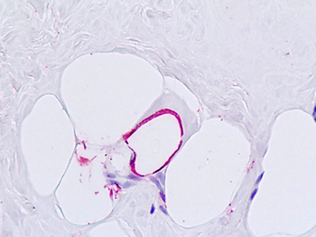 GCGR/Glucagon Receptor Antibody