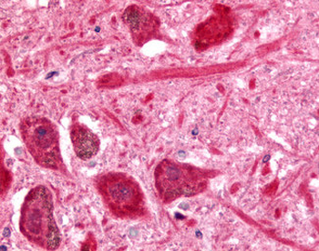 PACE4/PCSK6 Antibody