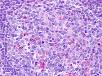 CCR7 Antibody