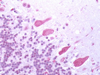 VMD2L3/BEST3 Antibody