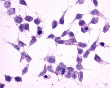 GRM2/MGLUR2 Antibody