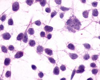 GRM3/MGLUR3 Antibody