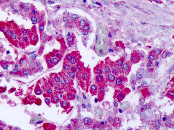 GRM7/MGLUR7 Antibody