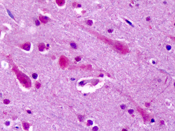 GRM7/MGLUR7 Antibody