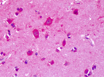 GRM8/MGLUR8 Antibody