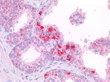c-Kit/CD117 Antibody