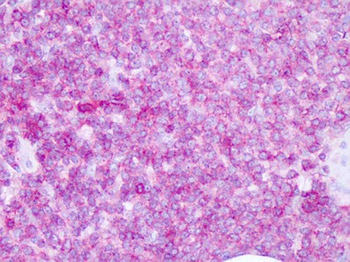 CD45/LCA Antibody