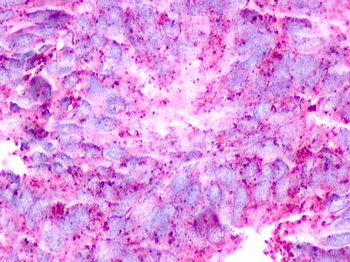 GPCRW/GPR18 Antibody