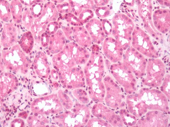 PTGER3/EP3 Antibody