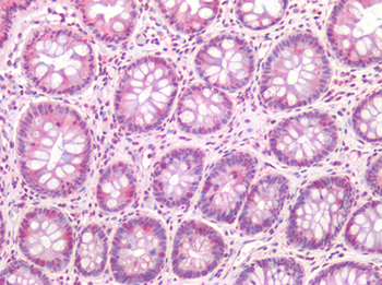 TM9SF4 Antibody