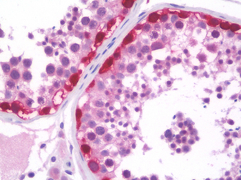 MAGEA3 Antibody