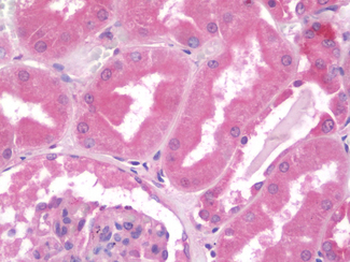 HAND1 Antibody