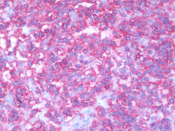 HLA-A/B/C Antibody
