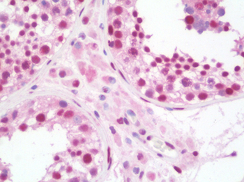 STAT5A Antibody