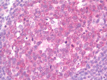 IL17RE Antibody