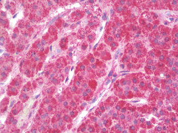 CCL4/MIP-1 Beta Antibody
