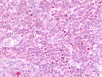 IL15 Antibody
