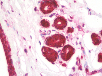 KREMEN1/KREMEN-1 Antibody