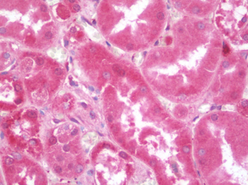 APOE/Apolipoprotein E Antibody