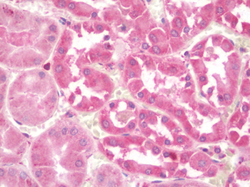 ULK1 Antibody