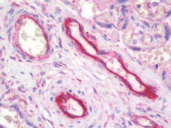 TFPI/LACI Antibody
