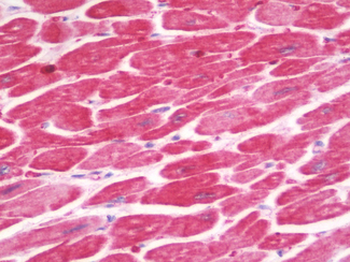 IL1RL2 Antibody