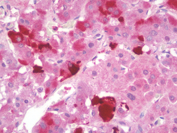 ENHO/Adropin Antibody
