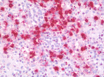CXCR3 Antibody