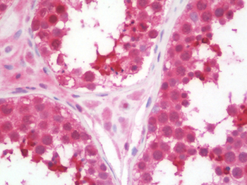 UCP1/UCP-1 Antibody