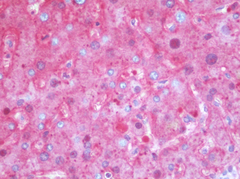 SERPINA1 / Alpha 1 Antitrypsin Antibody (clone 11G2)
