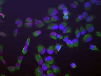SF3B4 Antibody