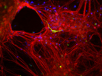 INA/Alpha Internexin Antibody