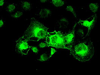 CRYAB/Alpha B Crystallin Antibody