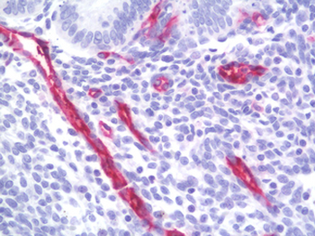 PECAM-1/CD31 Antibody