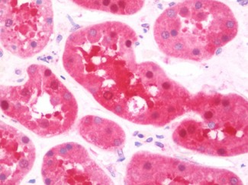 PSPH Antibody