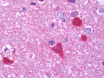 PPP3CB Antibody