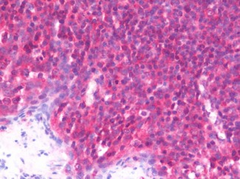 PCMT1 Antibody