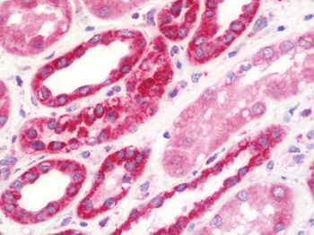 NDUFS2 Antibody