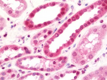 NUDR/DEAF1 Antibody