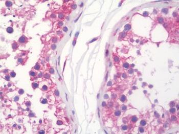 WFS1 Antibody